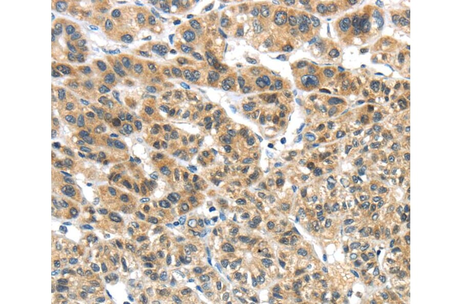 Immunohistochemistry - TKTL1 Antibody from Signalway Antibody (40152) - Antibodies.com