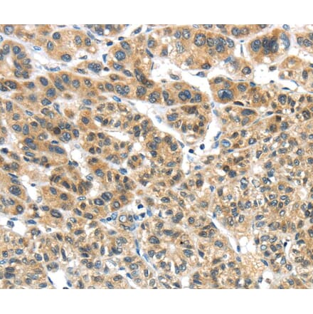Immunohistochemistry - TKTL1 Antibody from Signalway Antibody (40152) - Antibodies.com