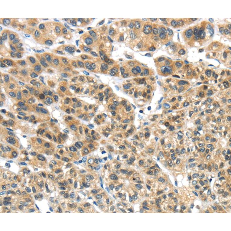 Immunohistochemistry - TKTL1 Antibody from Signalway Antibody (40152) - Antibodies.com
