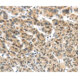 Immunohistochemistry - TKTL1 Antibody from Signalway Antibody (40152) - Antibodies.com