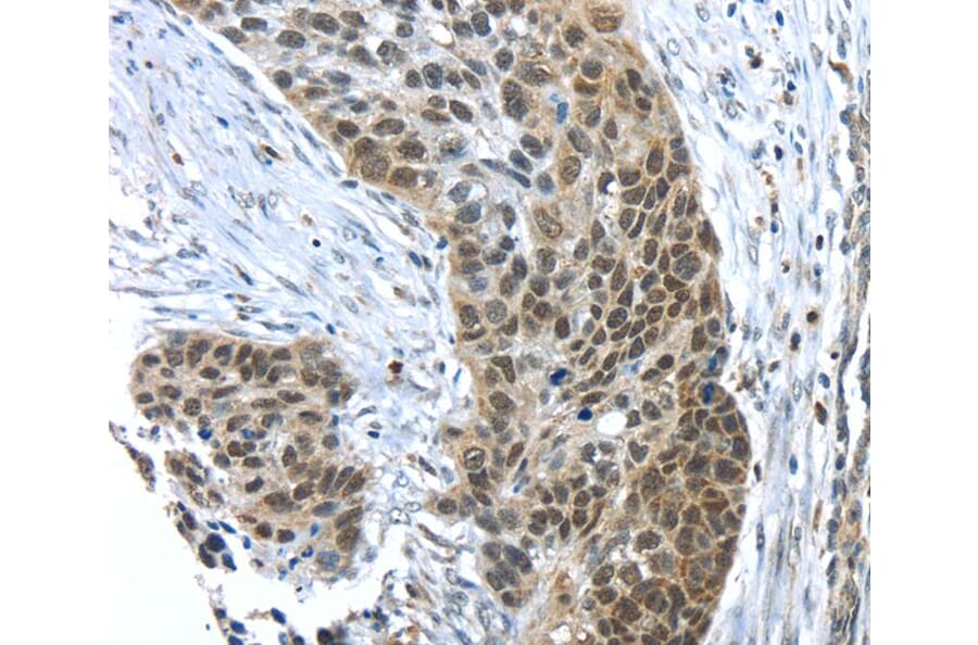 Immunohistochemistry - TKTL1 Antibody from Signalway Antibody (40152) - Antibodies.com