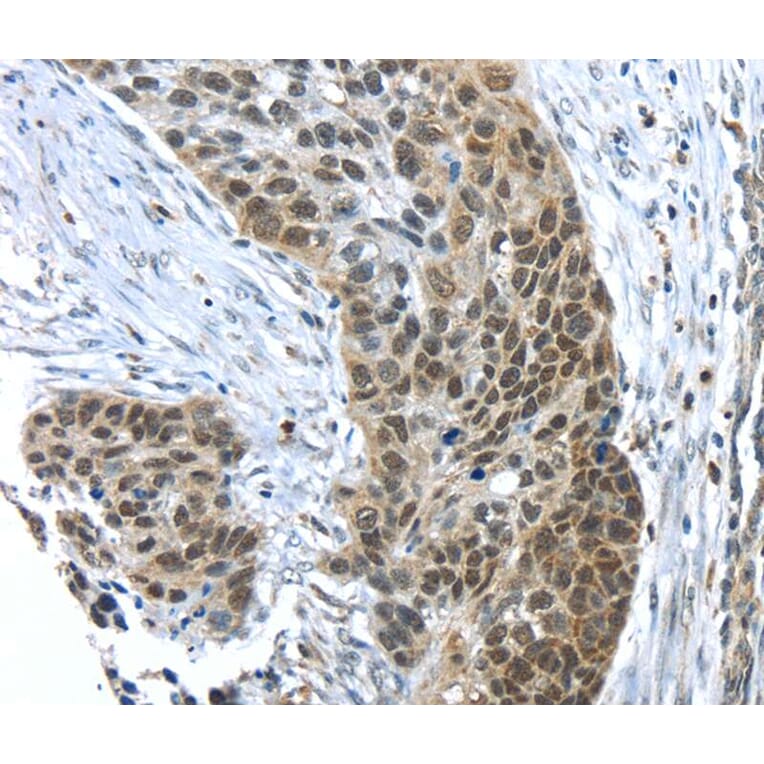 Immunohistochemistry - TKTL1 Antibody from Signalway Antibody (40152) - Antibodies.com
