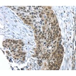Immunohistochemistry - TKTL1 Antibody from Signalway Antibody (40152) - Antibodies.com