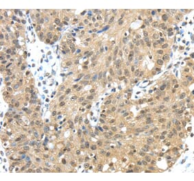 Immunohistochemistry - TMED3 Antibody from Signalway Antibody (40155) - Antibodies.com