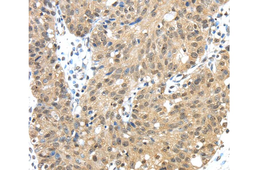 Immunohistochemistry - TMED3 Antibody from Signalway Antibody (40155) - Antibodies.com