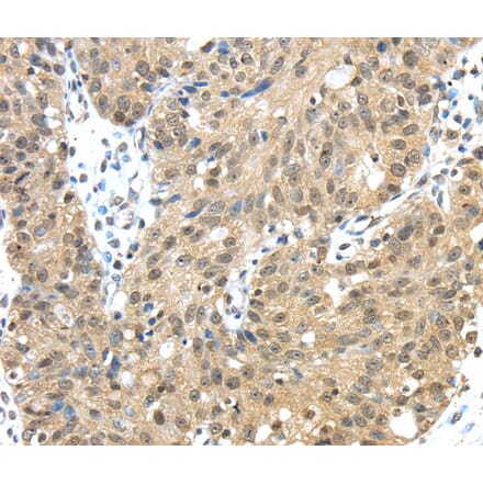 Immunohistochemistry - TMED3 Antibody from Signalway Antibody (40155) - Antibodies.com