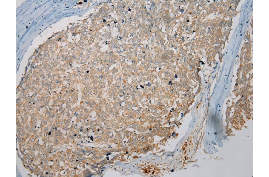 Immunohistochemistry - TPSB2 Antibody from Signalway Antibody (40165) - Antibodies.com