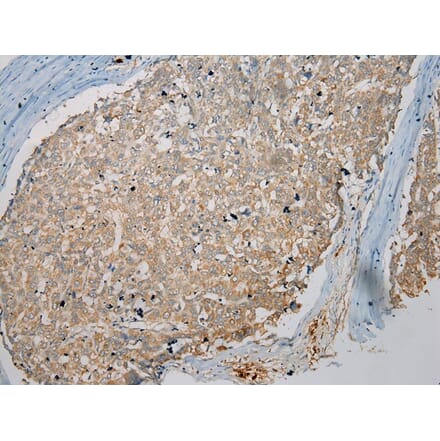 Immunohistochemistry - TPSB2 Antibody from Signalway Antibody (40165) - Antibodies.com