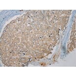 Immunohistochemistry - TPSB2 Antibody from Signalway Antibody (40165) - Antibodies.com