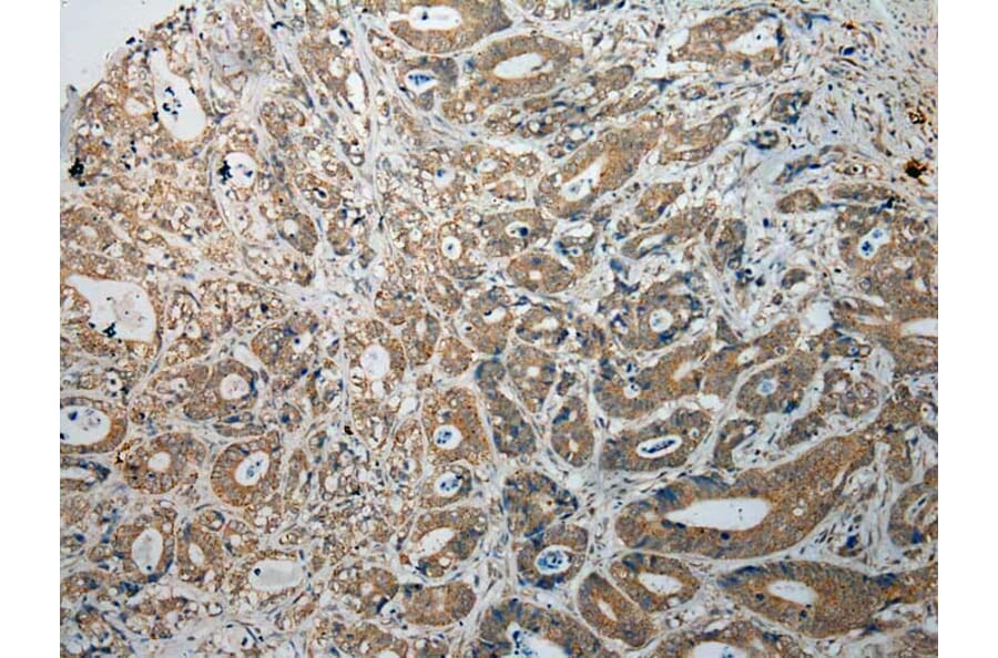 Immunohistochemistry - TPSB2 Antibody from Signalway Antibody (40165) - Antibodies.com