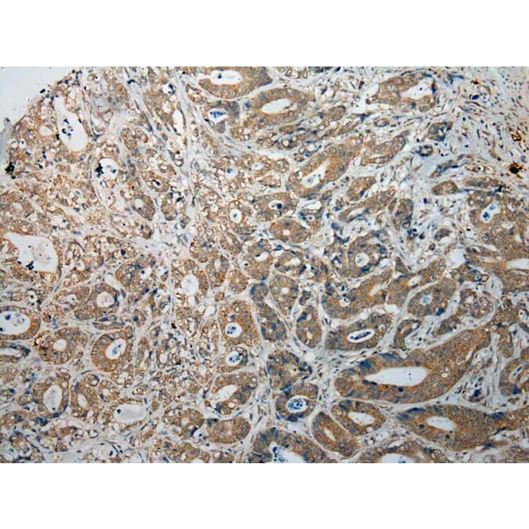 Immunohistochemistry - TPSB2 Antibody from Signalway Antibody (40165) - Antibodies.com