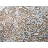 Immunohistochemistry - TPSB2 Antibody from Signalway Antibody (40165) - Antibodies.com