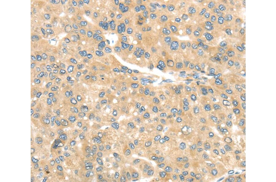 Immunohistochemistry - TRAK1 Antibody from Signalway Antibody (40166) - Antibodies.com