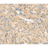 Immunohistochemistry - TRAK1 Antibody from Signalway Antibody (40166) - Antibodies.com