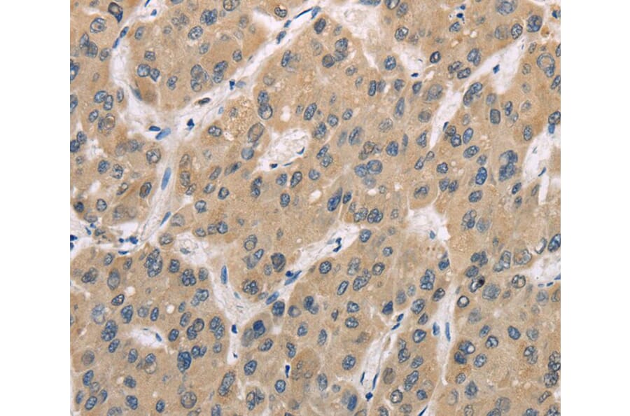 Immunohistochemistry - TRIB3 Antibody from Signalway Antibody (40167) - Antibodies.com