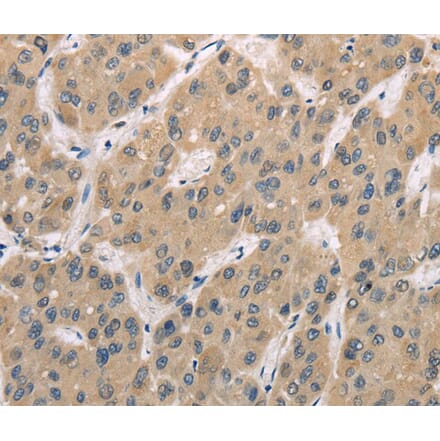 Immunohistochemistry - TRIB3 Antibody from Signalway Antibody (40167) - Antibodies.com