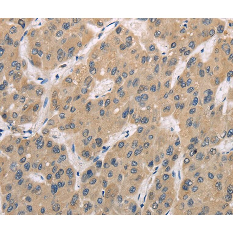 Immunohistochemistry - TRIB3 Antibody from Signalway Antibody (40167) - Antibodies.com