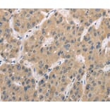 Immunohistochemistry - TRIB3 Antibody from Signalway Antibody (40167) - Antibodies.com