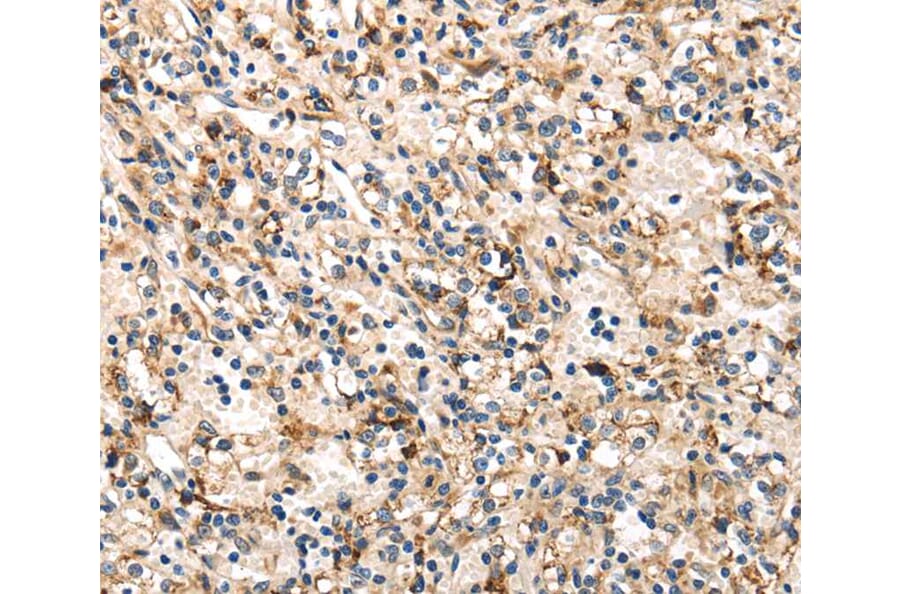 Immunohistochemistry - TRIB3 Antibody from Signalway Antibody (40167) - Antibodies.com