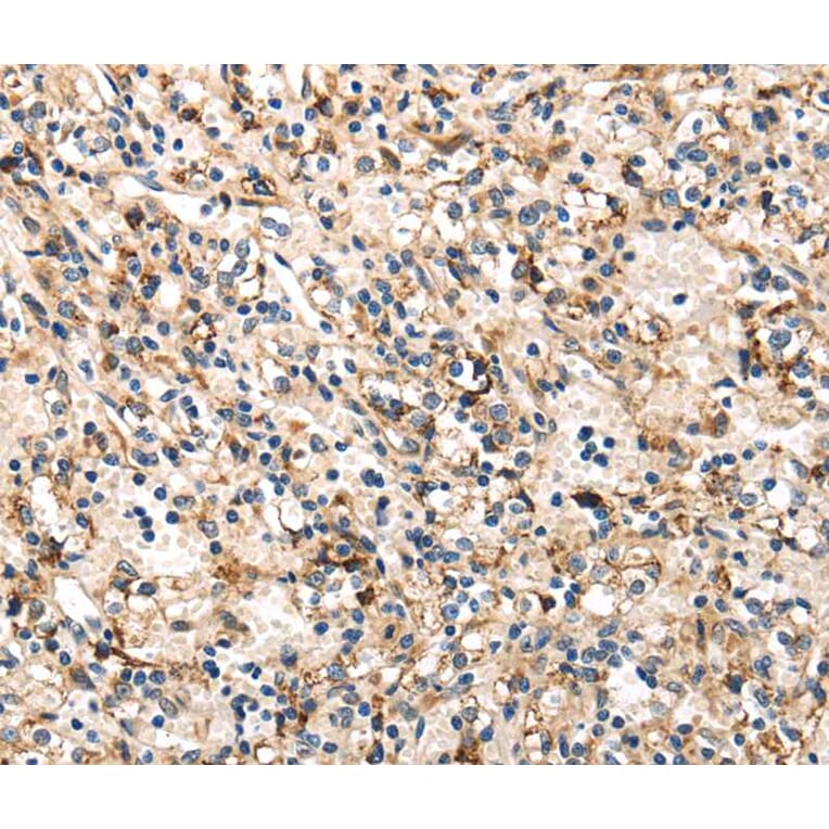 Immunohistochemistry - TRIB3 Antibody from Signalway Antibody (40167) - Antibodies.com