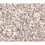 Immunohistochemistry - TRIB3 Antibody from Signalway Antibody (40167) - Antibodies.com