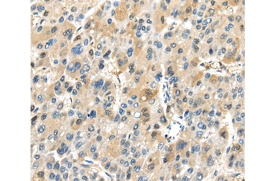Immunohistochemistry - TRAIP Antibody from Signalway Antibody (40169) - Antibodies.com