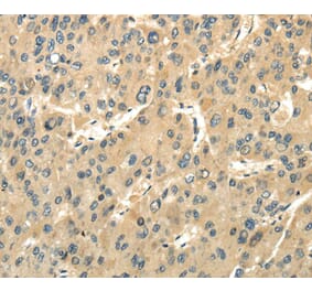 Immunohistochemistry - UBAP1 Antibody from Signalway Antibody (40173) - Antibodies.com