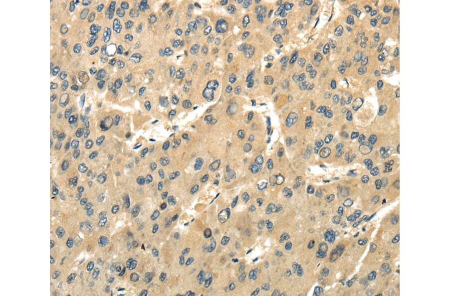 Immunohistochemistry - UBAP1 Antibody from Signalway Antibody (40173) - Antibodies.com