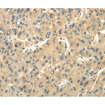 Immunohistochemistry - UBAP1 Antibody from Signalway Antibody (40173) - Antibodies.com