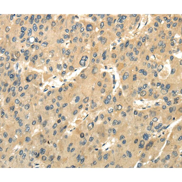Immunohistochemistry - UBAP1 Antibody from Signalway Antibody (40173) - Antibodies.com