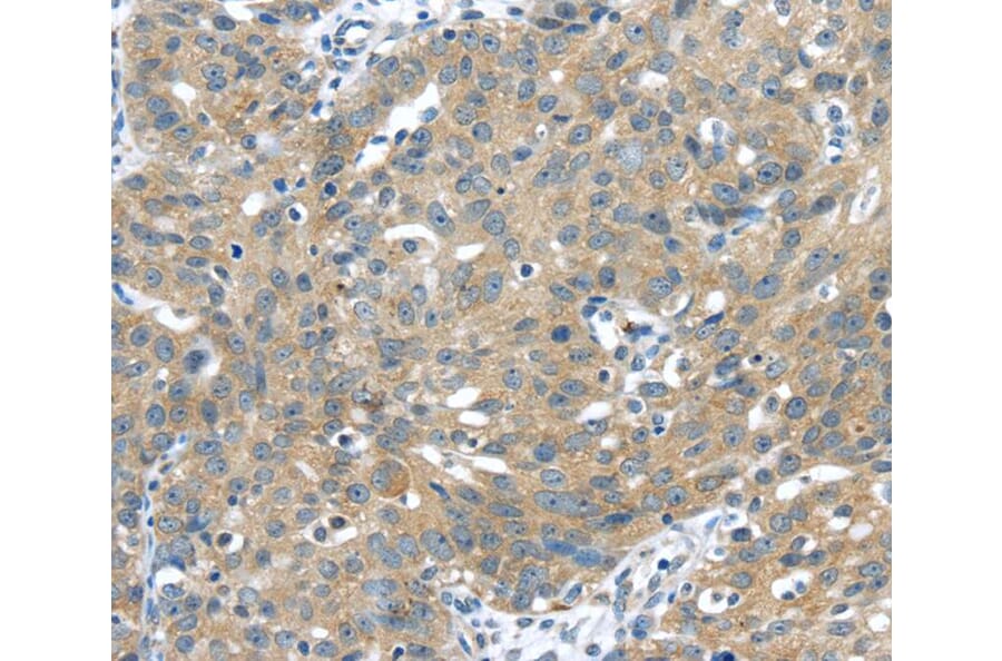 Immunohistochemistry - UCHL3 Antibody from Signalway Antibody (40176) - Antibodies.com