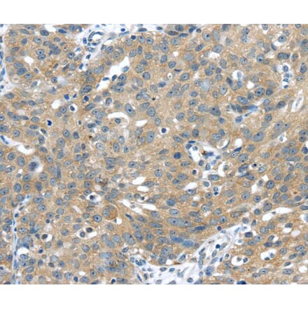 Immunohistochemistry - UCHL3 Antibody from Signalway Antibody (40176) - Antibodies.com