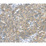 Immunohistochemistry - UCHL3 Antibody from Signalway Antibody (40176) - Antibodies.com