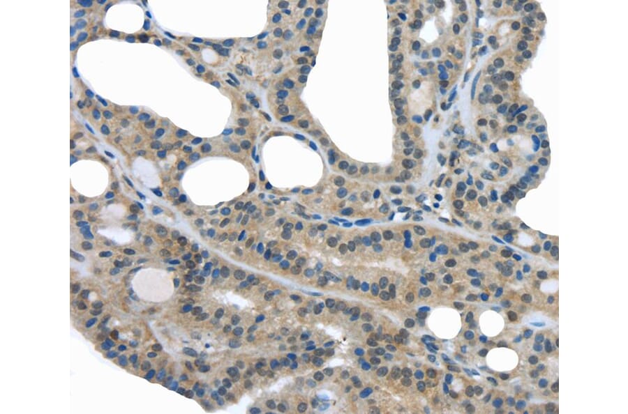 Immunohistochemistry - UCHL3 Antibody from Signalway Antibody (40176) - Antibodies.com