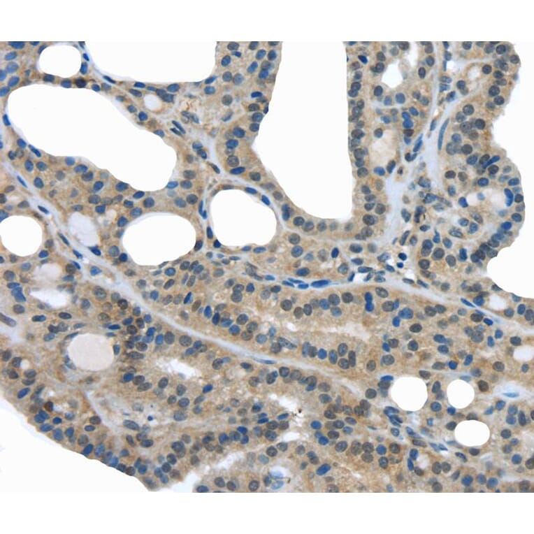 Immunohistochemistry - UCHL3 Antibody from Signalway Antibody (40176) - Antibodies.com