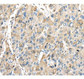 Immunohistochemistry - INHBB Antibody from Signalway Antibody (40186) - Antibodies.com