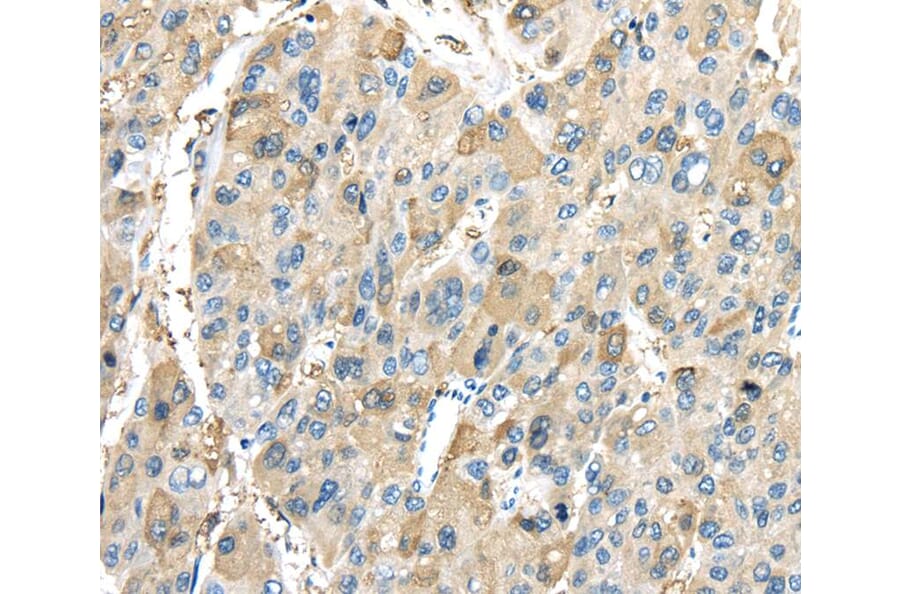 Immunohistochemistry - INHBB Antibody from Signalway Antibody (40186) - Antibodies.com
