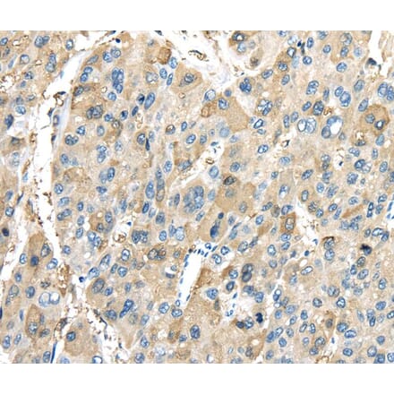 Immunohistochemistry - INHBB Antibody from Signalway Antibody (40186) - Antibodies.com