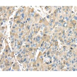 Immunohistochemistry - INHBB Antibody from Signalway Antibody (40186) - Antibodies.com