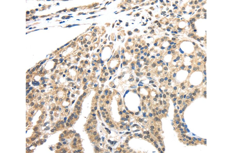 Immunohistochemistry - INHBB Antibody from Signalway Antibody (40186) - Antibodies.com