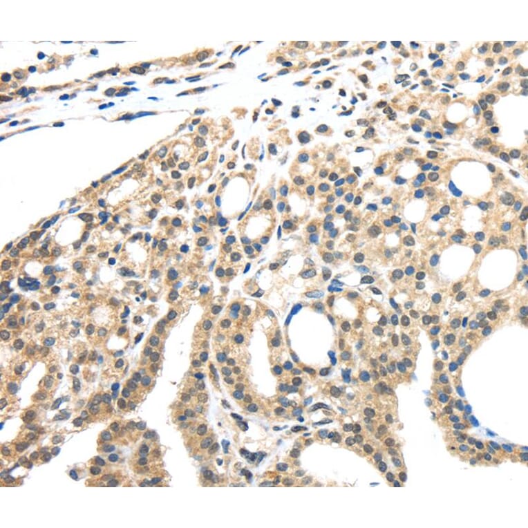 Immunohistochemistry - INHBB Antibody from Signalway Antibody (40186) - Antibodies.com