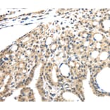 Immunohistochemistry - INHBB Antibody from Signalway Antibody (40186) - Antibodies.com