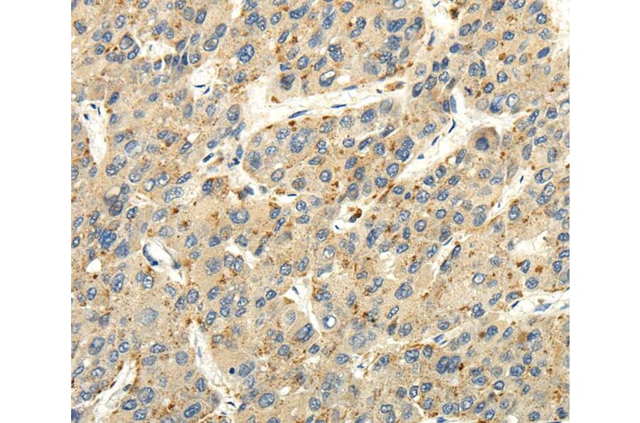 Immunohistochemistry - STRA6 Antibody from Signalway Antibody (40194) - Antibodies.com
