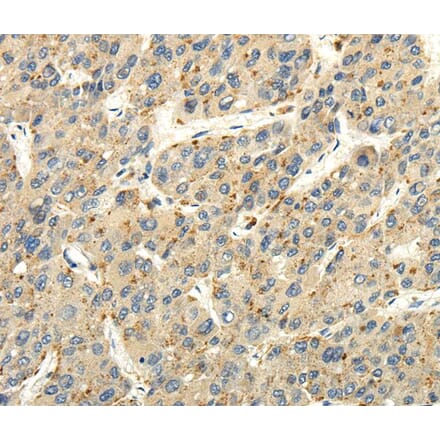 Immunohistochemistry - STRA6 Antibody from Signalway Antibody (40194) - Antibodies.com
