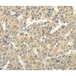 Immunohistochemistry - STRA6 Antibody from Signalway Antibody (40194) - Antibodies.com