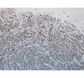 Immunohistochemistry - S1PR2 Antibody from Signalway Antibody (40195) - Antibodies.com