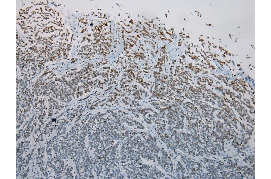 Immunohistochemistry - S1PR2 Antibody from Signalway Antibody (40195) - Antibodies.com