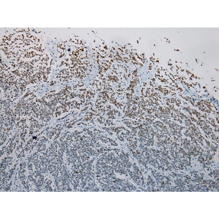 Immunohistochemistry - S1PR2 Antibody from Signalway Antibody (40195) - Antibodies.com