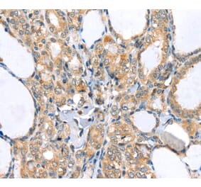 Immunohistochemistry - LLGL2 Antibody from Signalway Antibody (40198) - Antibodies.com