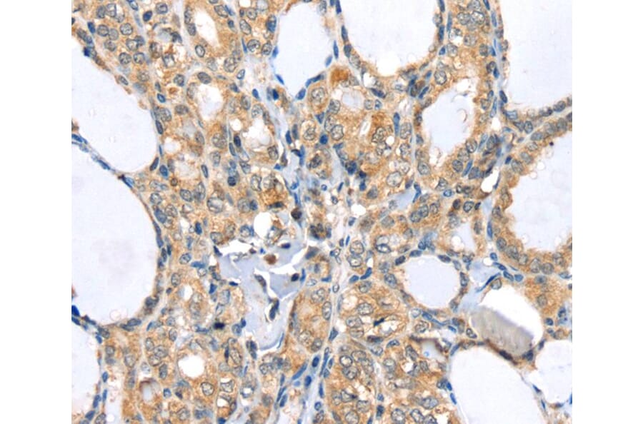 Immunohistochemistry - LLGL2 Antibody from Signalway Antibody (40198) - Antibodies.com
